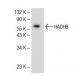 HADHB Antibody (D-10) - Western Blotting - Image 145622