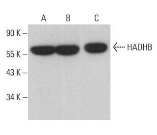 HADHB Antibody (D-10) - Western Blotting - Image 375375 
