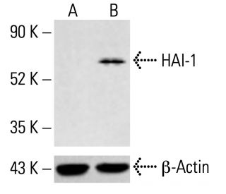 HAI-1 Antibody (H-1) - Western Blotting - Image 413504
