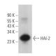 HAI-2 Antibody (H-9) - Western Blotting - Image 366585