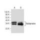 Halotyrosine Antibody (BTK-94C) - Western Blotting - Image 282252