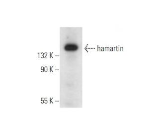 hamartin Antibody (A-2) - Western Blotting - Image 332798 