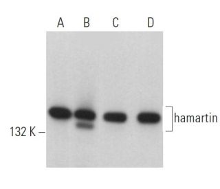 hamartin Antibody (C-8) - Western Blotting - Image 362959 