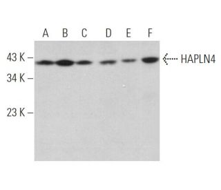 HAPLN4 Antibody (H-6) - Western Blotting - Image 371353 