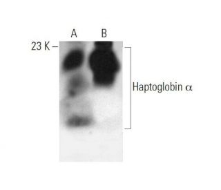 Haptoglobin &alpha; Antibody (E-9) - Western Blotting - Image 353416 