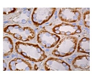 HAS3 Antibody (G-12) - Immunohistochemistry - Image 161031 