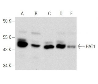 HAT1 Antibody (G-12) - Western Blotting - Image 357304 