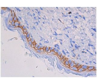 CD44 Antibody (IRAWB 14.4) - Immunohistochemistry - Image 357884