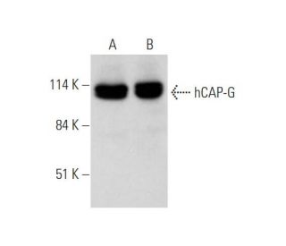 hCAP-G Antibody (B-1) - Western Blotting - Image 345917 