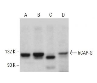 hCAP-G Antibody (B-1) - Western Blotting - Image 379170