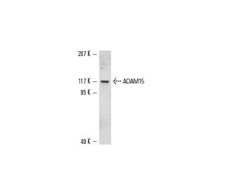 ADAM15 (V-20): sc-16529. Western blot analysis of ADAM15 expression in HCT-116 whole cell lysate. 