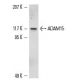 ADAM15 (V-20): sc-16529. Western blot analysis of ADAM15 expression in HCT-116 whole cell lysate. 
