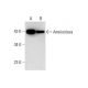 Amnionless Antibody (C-10) - Western Blotting - Image 144842