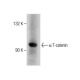 α T-catenin (N-14): sc-69150. Western blot analysis of α T-catenin expression in HCT-8 whole cell lysate.