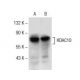 Histone Deacetylase 10 (HDAC10) Antibody (F-4) - Western Blotting - Image 154068 