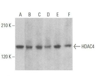 Histone Deacetylase 4 (HDAC4) Antibody (F-6) - Western Blotting - Image 352363 