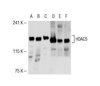 Histone Deacetylase 5 (HDAC5) Antibody (C-11) - Western Blotting - Image 54266 