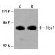 GLUD1/2 抗体 (C-10):sc-515542。通过蛋白质印迹分析未处理的 HCT-116(A)和经化学处理的 HCT-116(B、C)完整细胞裂解物中的 GLUD1/2 表达。β-肌动蛋白 (C4):sc-47778 用作加载对照。使用的检测试剂:m-IgG Fc BP-HRP:sc-525409。 Hec1 Antibody (C-11) - Western Blotting - Image 416038