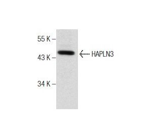 HEK293 Whole Cell Lysate: sc-45136. Western blot analysis of HAPLN3... 