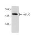 HEK293 Whole Cell Lysate: sc-45136. Western blot analysis of HAPLN3... 