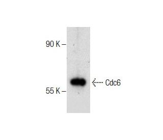 HEK293T Whole Cell Lysate: sc-45137. Western blot analysis of Cdc6... 