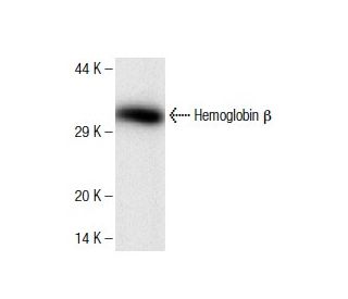 Hemoglobin &beta; Antibody (21) - Western Blotting - Image 136760