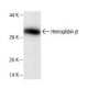 Hemoglobin β Antibody (21) - Western Blotting - Image 136760