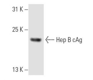 Hep B cAg Antibody (10E11) - Western Blotting - Image 8847