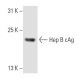 Hep B cAg Antibody (10E11) - Western Blotting - Image 8847