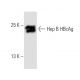 Hep B cAg Antibody (13A9) - Western Blotting - Image 8848