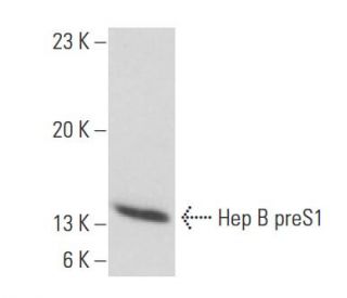 Hep B preS1 Antibody (AP1) - Western Blotting - Image 17692