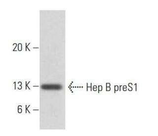 Hep B preS1 Antibody (AP2) - Western Blotting - Image 17727