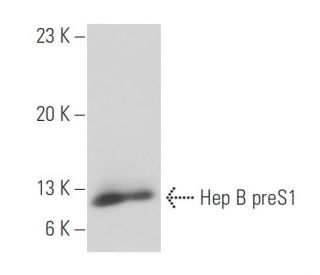 Hep B preS1 Antibody (KR127) - Western Blotting - Image 17693