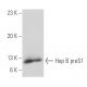 Hep B preS1 Antibody (KR127) - Western Blotting - Image 17693