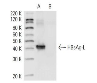 Hep B preS2 Antibody (S 26) - Western Blotting - Image 10583 