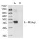 Hep B preS2 Antibody (S 26) - Western Blotting - Image 10583 