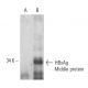 Hep B preS2 Antibody (S 26) - Western Blotting - Image 11500