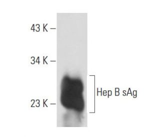 Hep B sAg Antibody (1023) - Western Blotting - Image 17233