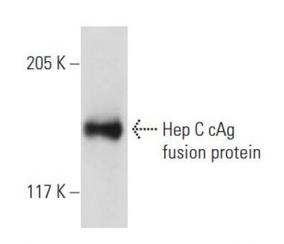 Hep C cAg Antibody (C7-50) - Western Blotting - Image 19126