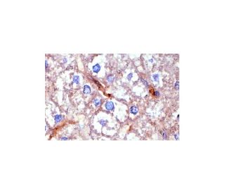 Hepatic Lipase Antibody (XHL1-1C) - Immunohistochemistry - Image 3752 