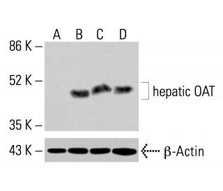 hepatic OAT Antibody (F-2) - Western Blotting - Image 414555 