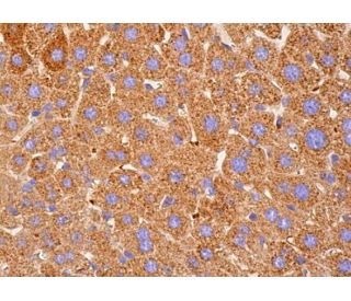 Hepatocyte Specific Antigen Antibody (OCH1E5) - Immunohistochemistry - Image 385396 