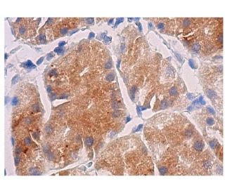 HES1 Antibody (E-5) - Immunohistochemistry - Image 281918 