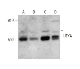 HEXA Antibody (D-2) - Western Blotting - Image 353396 