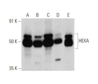 HEXA Antibody (E-2) - Western Blotting - Image 353436 