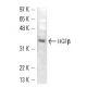 HGFβ Antibody (SBF5 C1.7) - Western Blotting - Image 13594