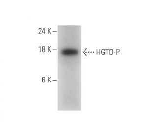 HGTD-P Antibody (E-8) - Western Blotting - Image 319978