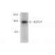 HGTD-P Antibody (E-8) - Western Blotting - Image 319978