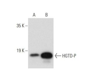 HGTD-P Antibody (H-4) - Western Blotting - Image 318361 