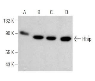 Hhip Antibody (5D11) - Western Blotting - Image 368241Each CRISPR/Cas9 Knockout (KO) Plasmid product consists of a pool of 3 plasmids designed to ensure identification and cleavage of a specific gene for maximum knockout efficiency. Each plasmid encodes a unique 20 nt sequence derived from the GeCKO (v2) library. 